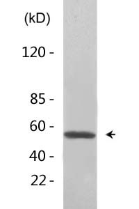 β-Tubulin Monoclonal Antibody(5G3)