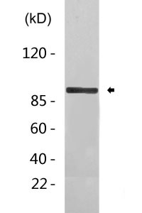 ABCB5 rabbit pAb