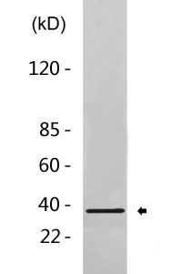 CABP2 rabbit pAb