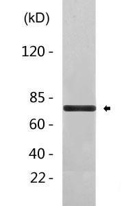 Truncated steroid 21-hydroxylase rabbit pAb