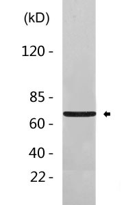 Mesothelin rabbit pAb