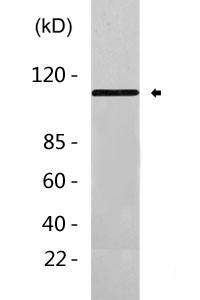 CD167a (Phospho Tyr792) rabbit pAb