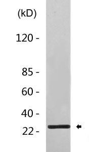 CD8A rabbit pAb