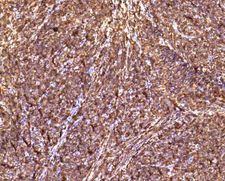 CD43抗体试剂（免疫组织化学）