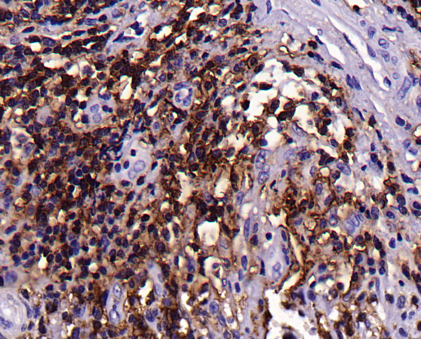 CD44抗体试剂（免疫组织化学）