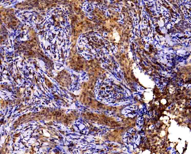 CD45抗体试剂（免疫组织化学）