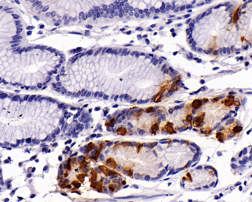 Gastrin抗体试剂（免疫组织化学）