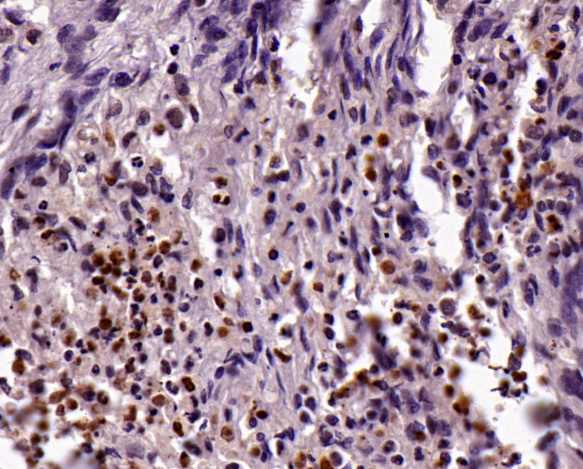 胶质纤维酸性蛋白（Glial Fibrillary Acidic Protein，GFAP）抗体试剂（免疫组织化学）