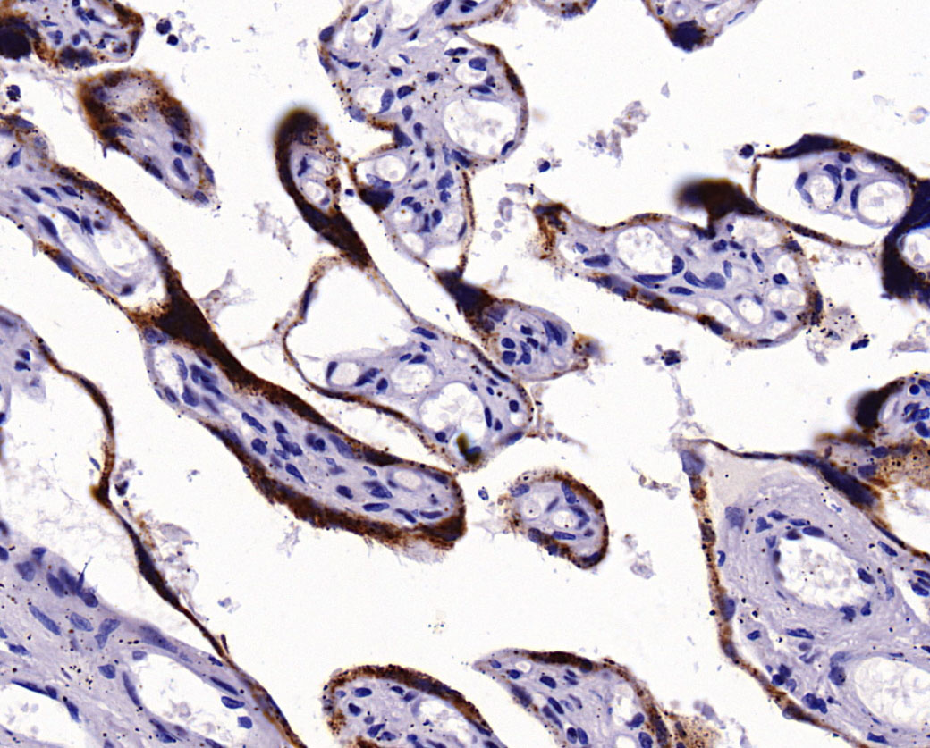 Human Chorionic Gonadotropin抗体试剂（免疫组织化学）